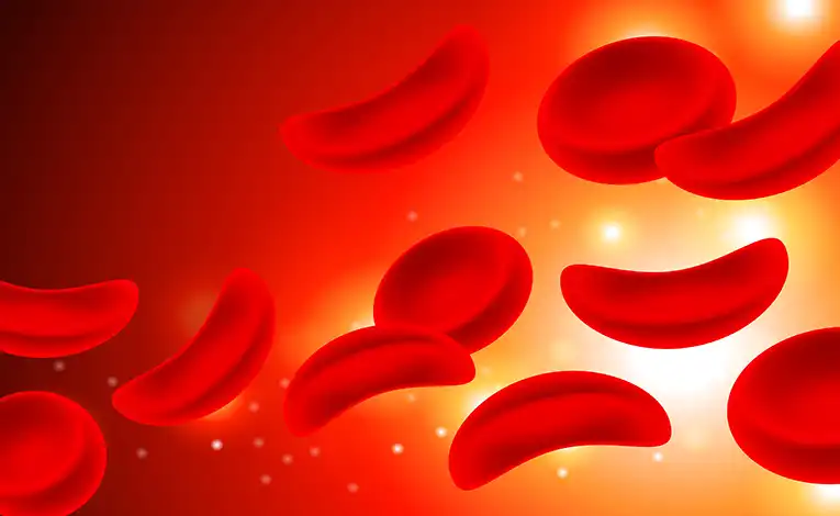 شکل گلبولهای قرمز در کم خونی داسی شکل